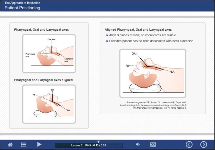 GUI screen-shot: OOORAM image depicting the correct alignment for intubation.